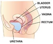 Bladder Prolapse Texas Bladder Prolapse Texas