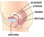 Rectal Prolapse Rectocele Rectal Prolapse Rectocele