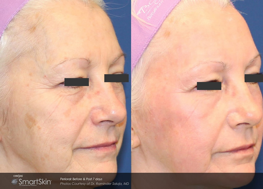 smartskin saluja case 02