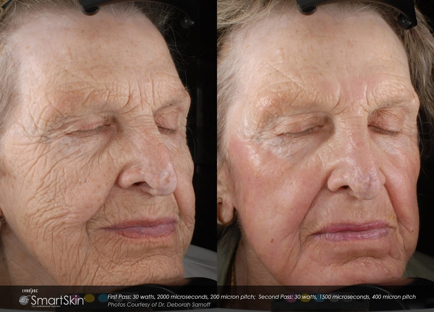 smartskin sarnoff case 03 smartskin sarnoff case 03