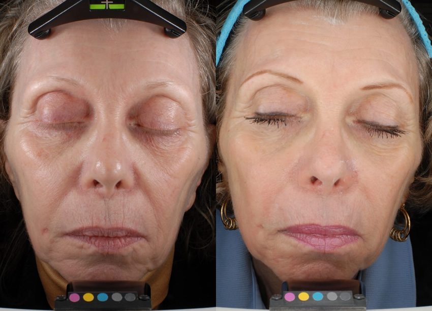 smartskin sarnoff case 05