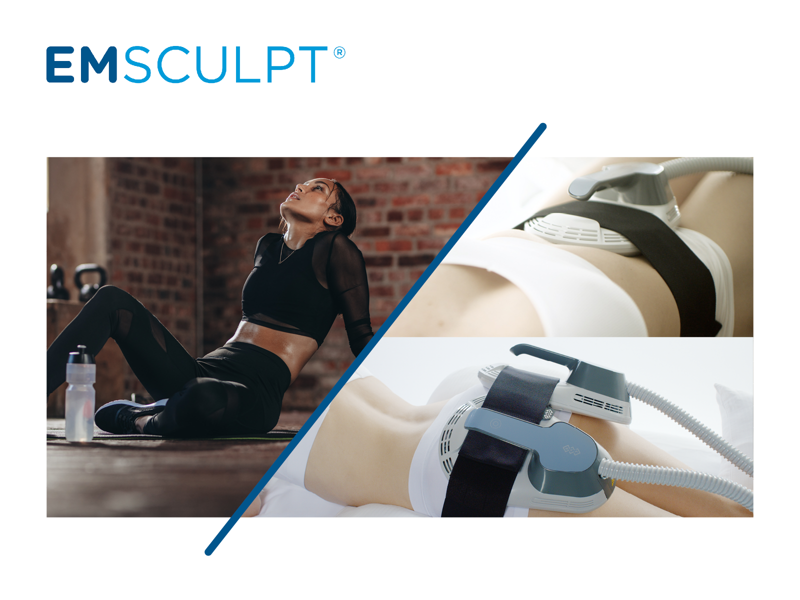 emsculpt pic fb social media plan 190101 en100 copy emsculpt pic fb social media plan 190101 en100 copy